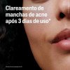 Sérum Tripla-Ação Facial Cetaphil Oil Control Controle de Oleisidade 30ml