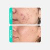 Creamy Skincare Creme Facial Glicointense Peel 30g