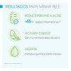 Sébium Global Bioderma Hidratante Anti-Imperfeições e Antimarcas da Acne